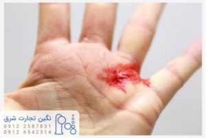 آب اکسیژنه به عنوان ضدعفونی کننده در بریدگی ها